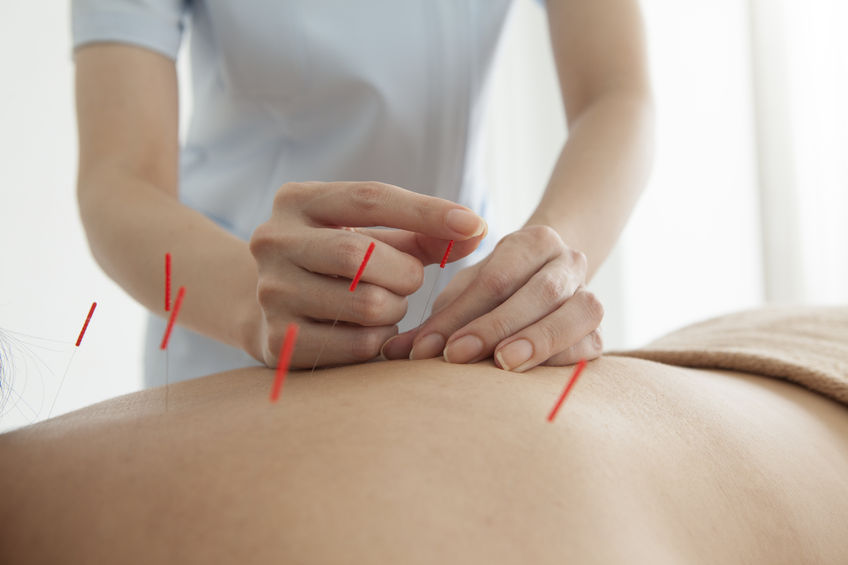pointing the acupuncture on the back of acupuncturists women